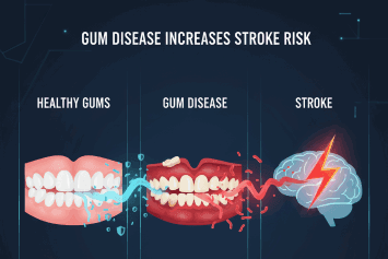 Can Gum Disease Increase Stroke Risk?