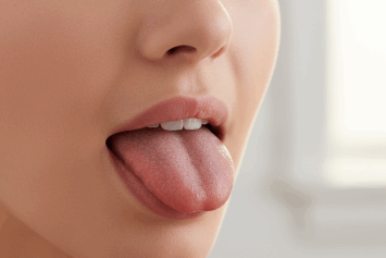 Why Tongue Cleaning Is Crucial for Your Oral Health