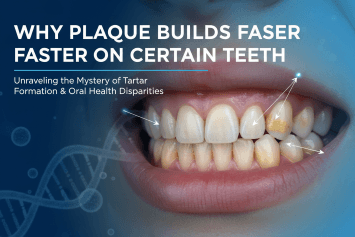 Why Plaque Builds Faster on Certain Teeth