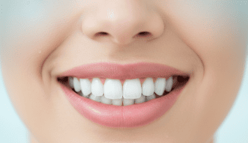 Elevating Oral Health with BrushO