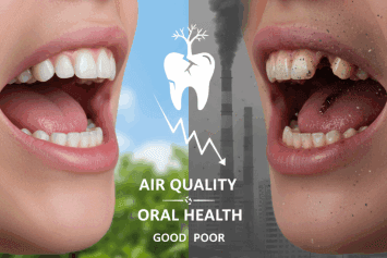 How Air Quality Affects Your Oral Health